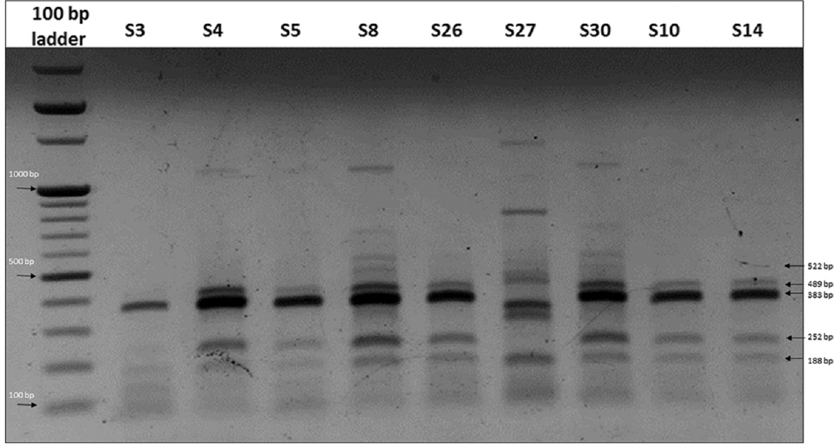 A representative 1.5 per cent agarose gel stained with ethidium bromide showing the amplification pattern obtained for Salmonella Typhi isolates using enterobacterial repetitive intergenic consensus-polymerase chain reaction (ERIC-PCR). Lanes 1-10, 100 bp ladder, S3, S4, S5, S8, S26, S27, S30, S10, S14.
